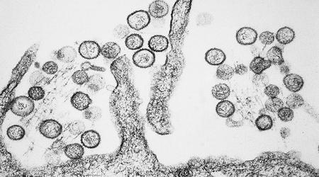 Australsk laboratorium mangler farlige vira på grund af frysesvigt