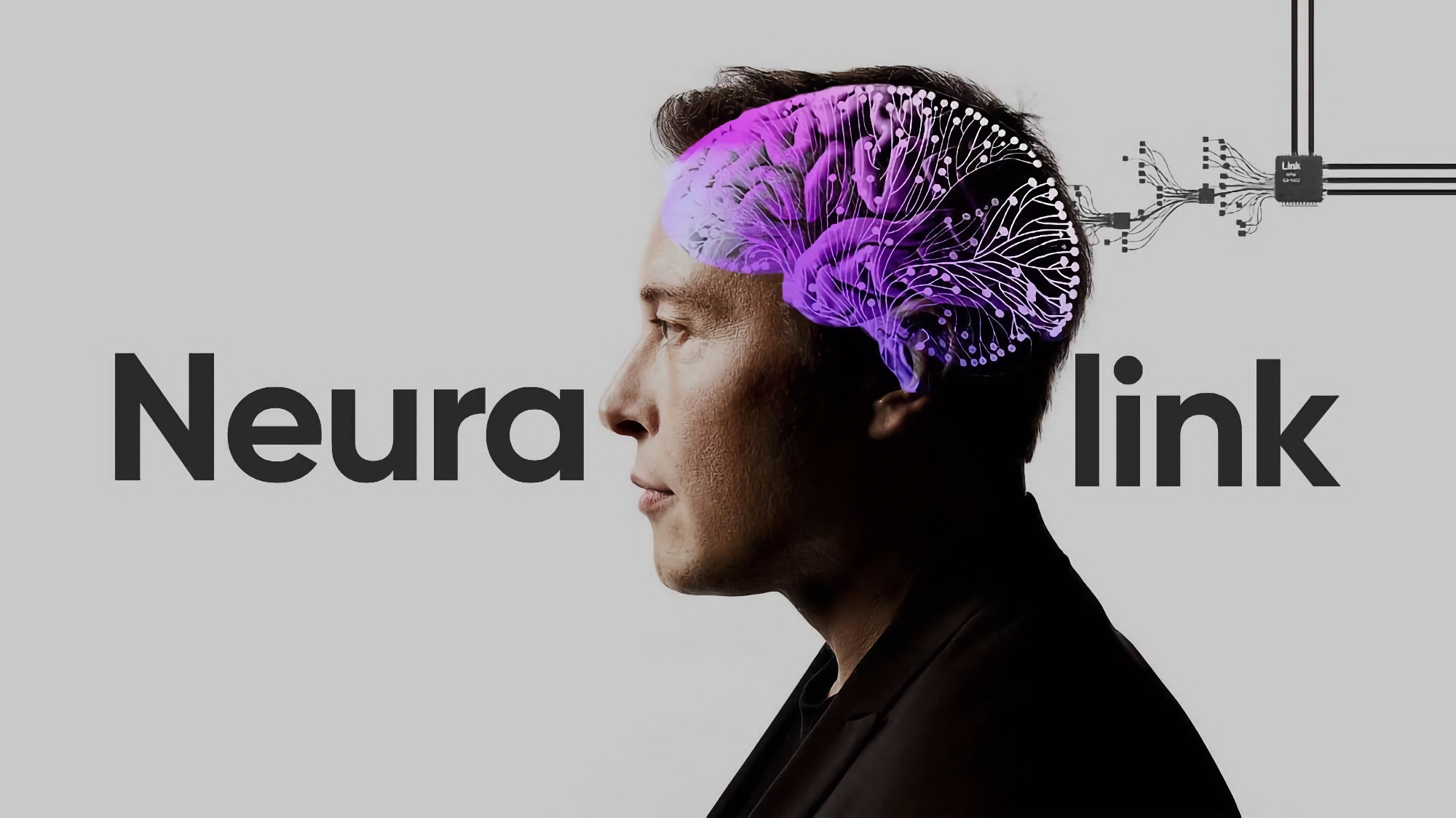 Elon Musk: Neuralink har indopereret det første implantat i en menneskehjerne