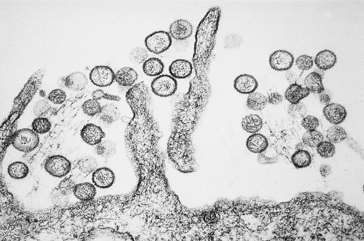 Et kig ind: et unikt mikrobillede af hantavirus