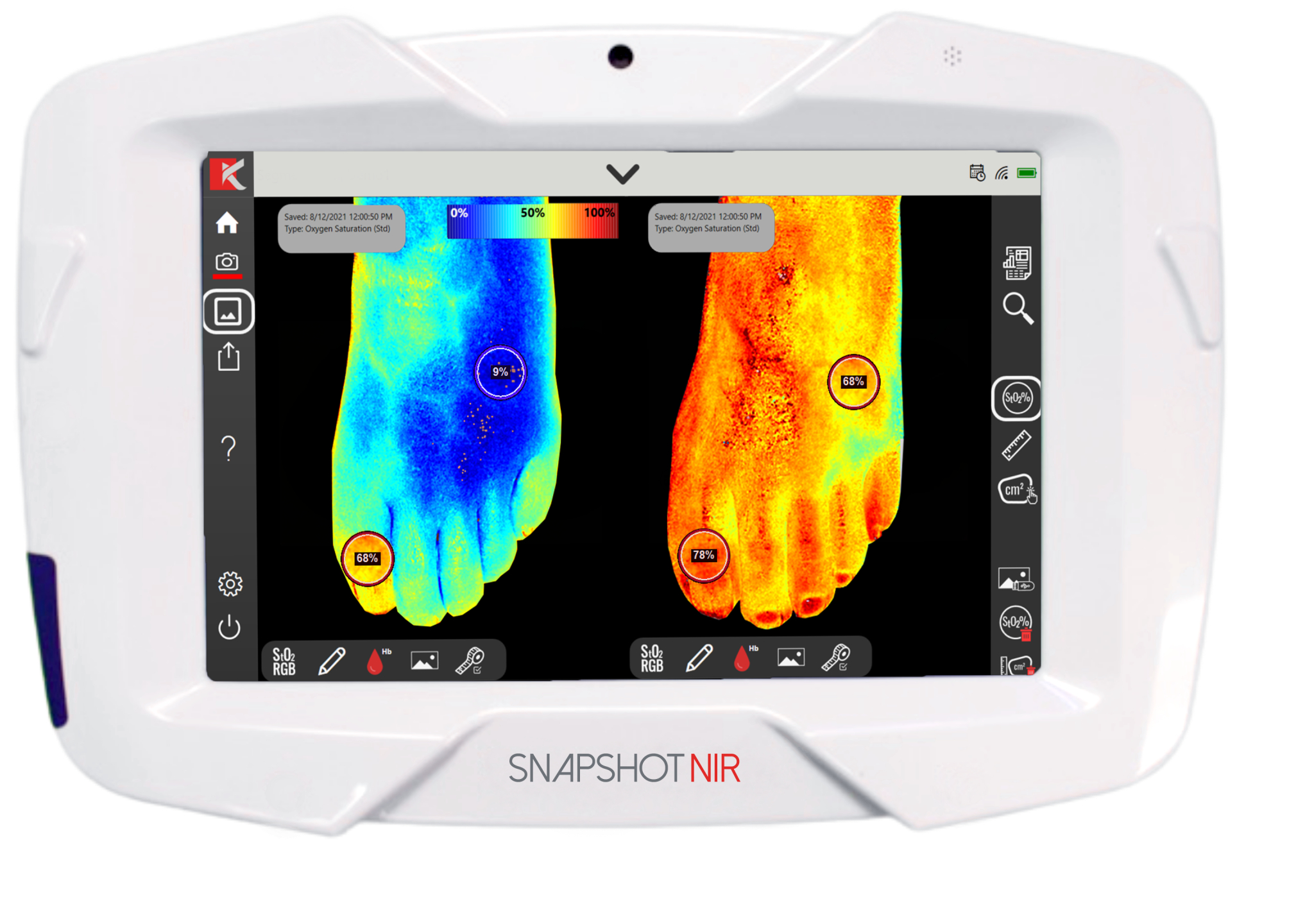 Bærbart diagnoseapparat "Snapshot NIR" skal erstatte ultralyd og røntgen